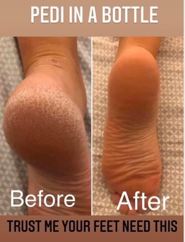 Pedicure in a bottle - Nu skin Sole solution foot treatment